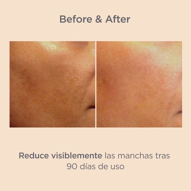 SERUM-CORRECTOR-DESPIGMENTANTE-MELACLEAR-ISDIN